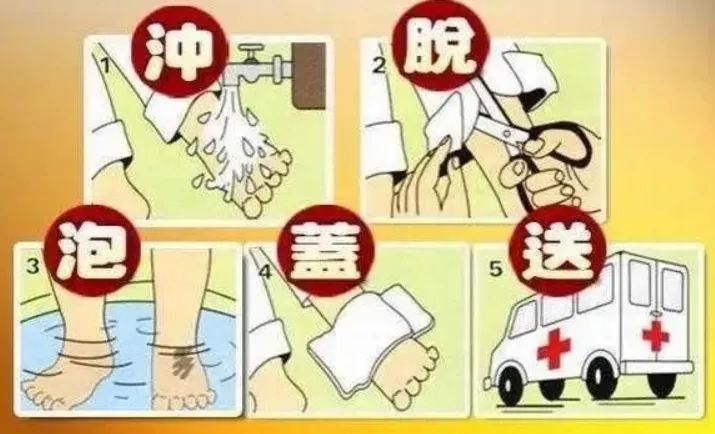 厨房热油、开水、蒸汽是烧烫伤高发原因，正确急救能大幅减轻疼痛
